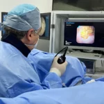 Litotripsia flexível a Laser - Dr. Marco Lipay Urologia