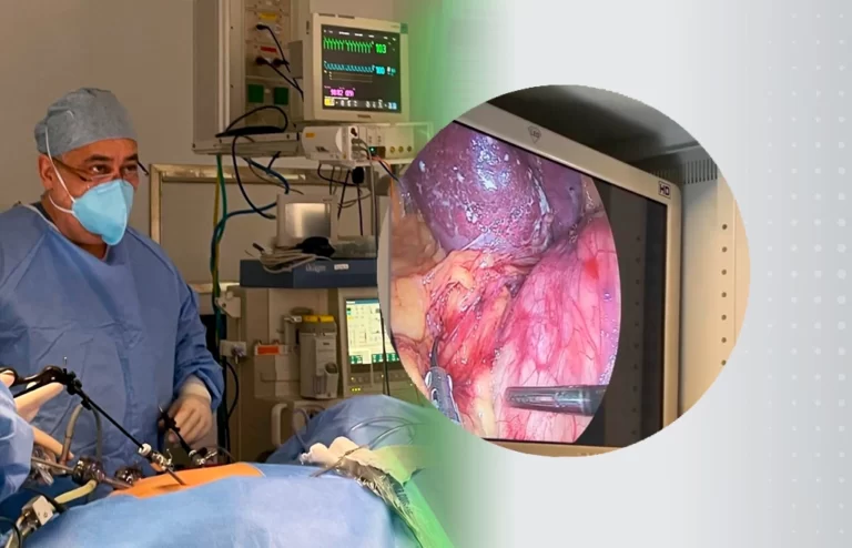 Videolaparoscopia - Dr. Marco Lipay Urologia